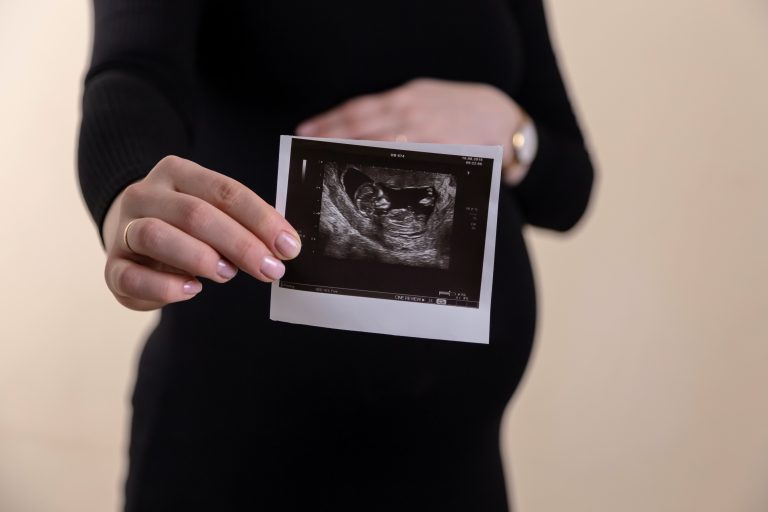 échographie bébé