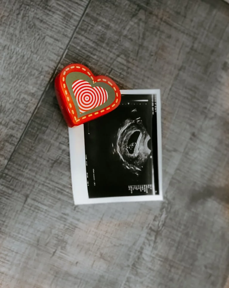 échographie bébé