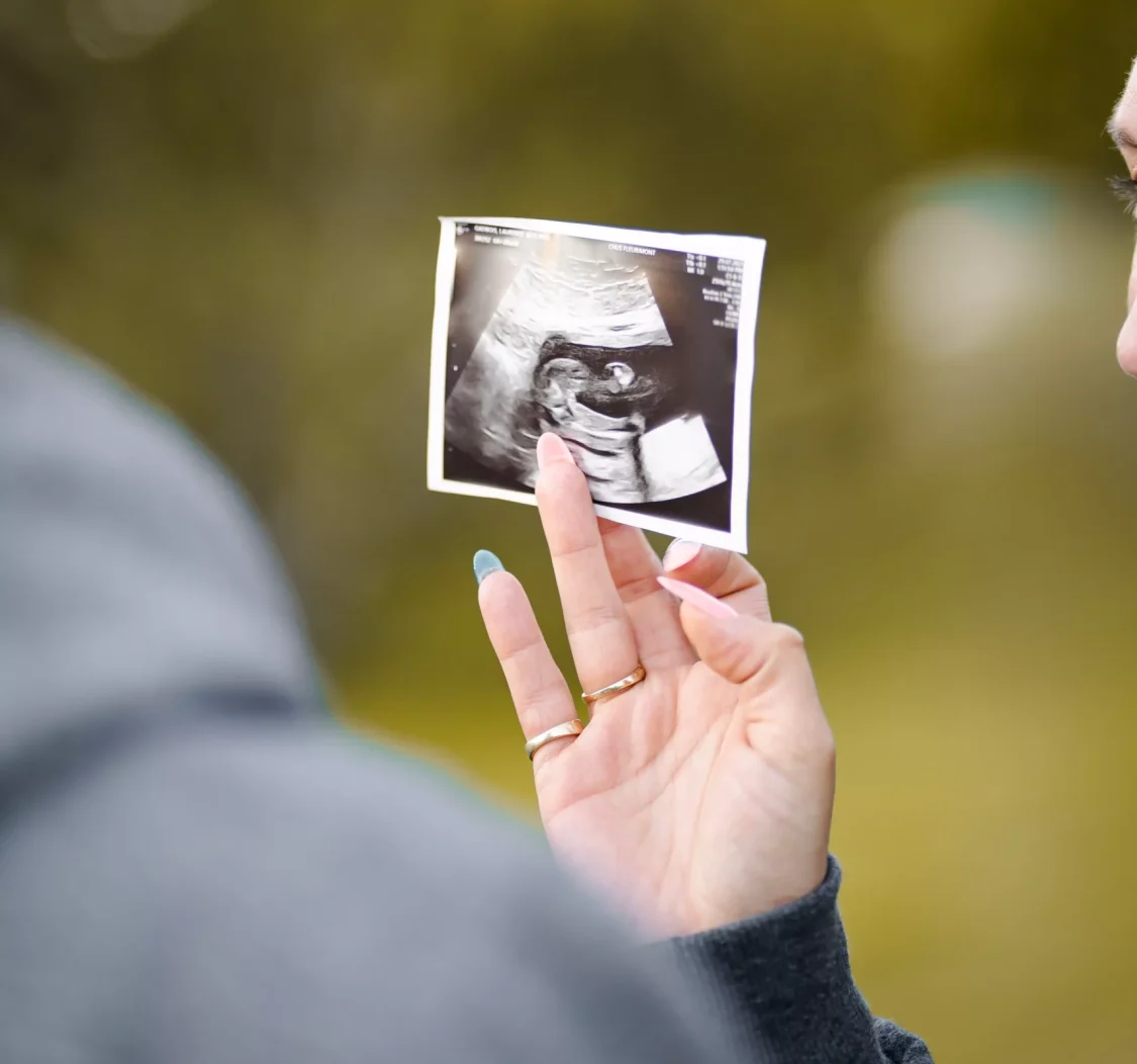 échographie bébé