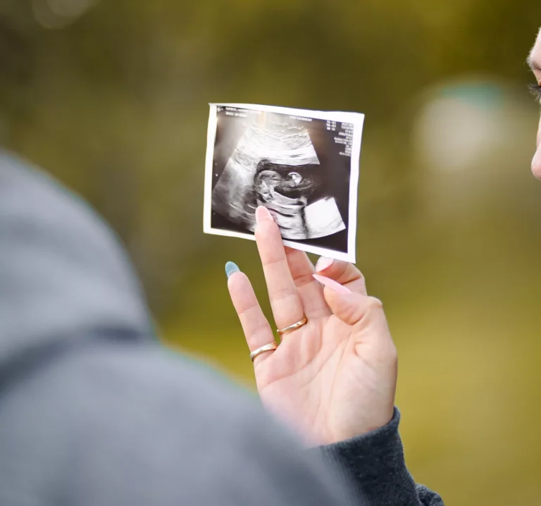échographie bébé