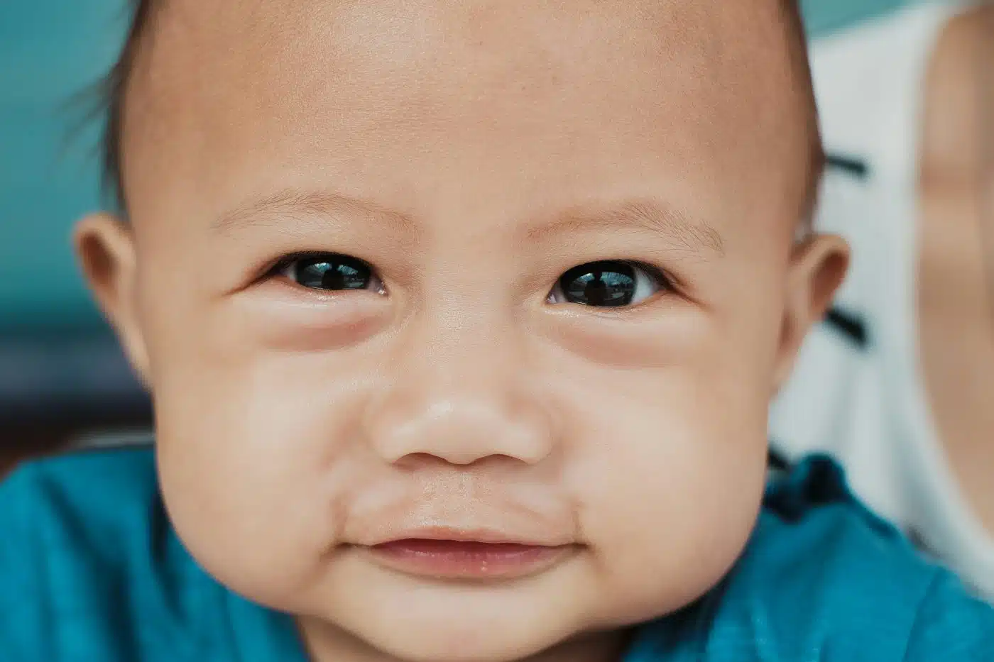 conjonctivite bébé
